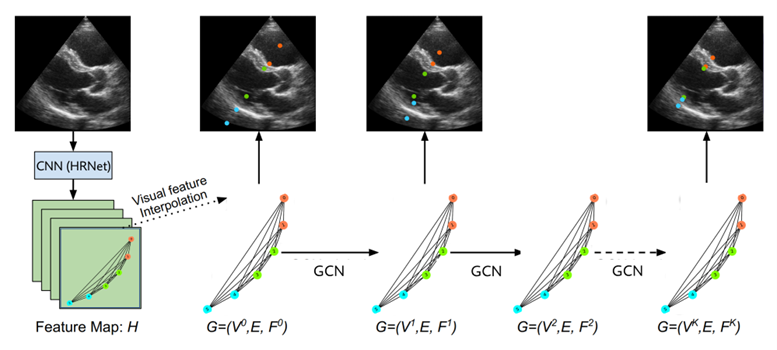 The figure shows an ultrasound using landmark detection in five parts.