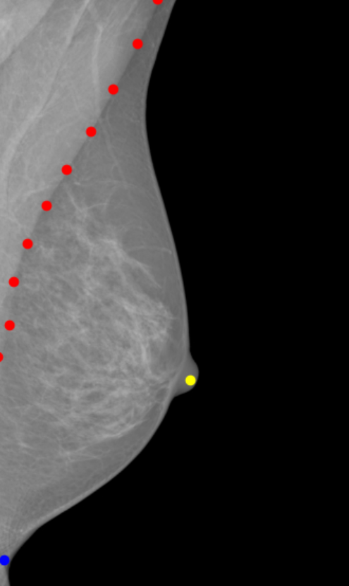 The image shows an x-ray of a breast in black and grey to illustrate image quality analysis: Red dots form a line down the side of the pectoral muscle, the blue point indicates the bottom edge of the breast, and the yellow one shows the nipple.