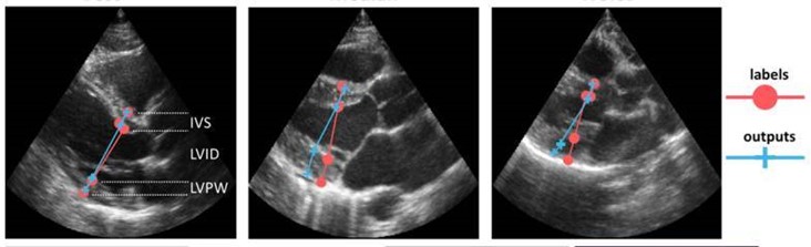 The image shows three ultrasound images where potential diseases and markers are marked in red.