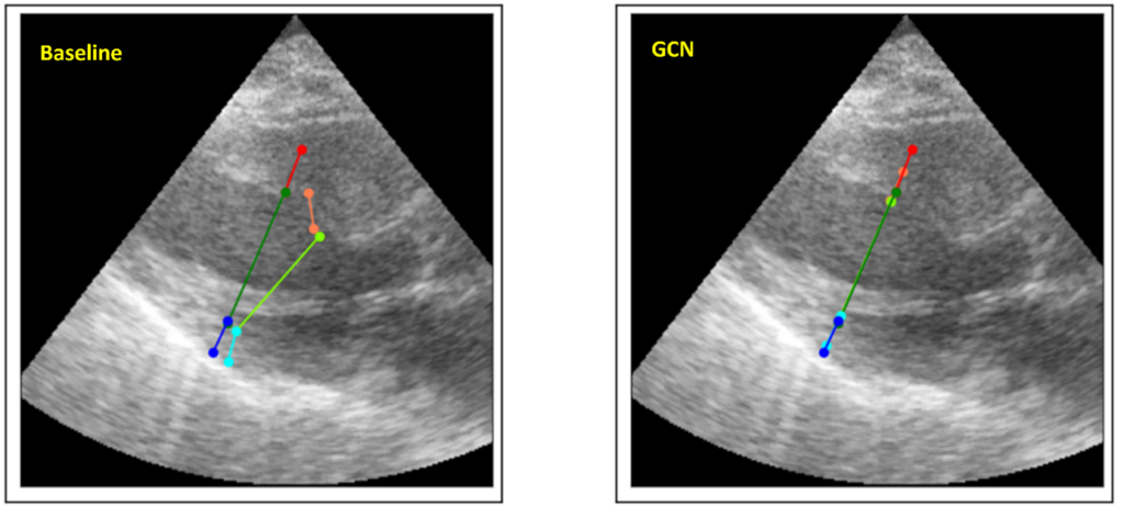 Two images displaying landmark positioning from ultrasound images. The images look similar to x-rays and positioning is marked in various colours.