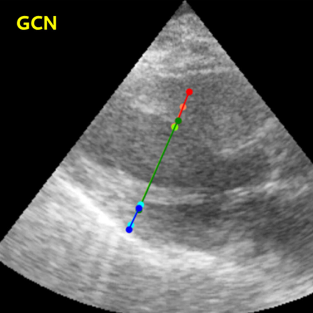 Graph convolutional network mapping measurement points in a cardiac ultrasound image, with points marked in blue, green, and red, and the rest in grayscale